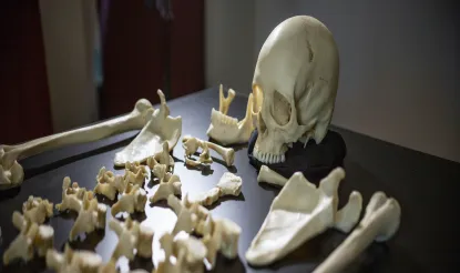 Dismembered Human Skeleton